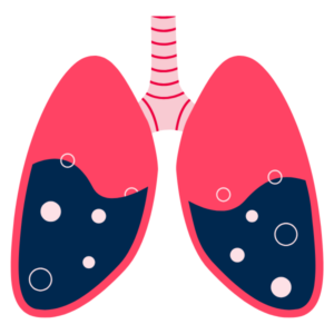 oxygen & circulation balance